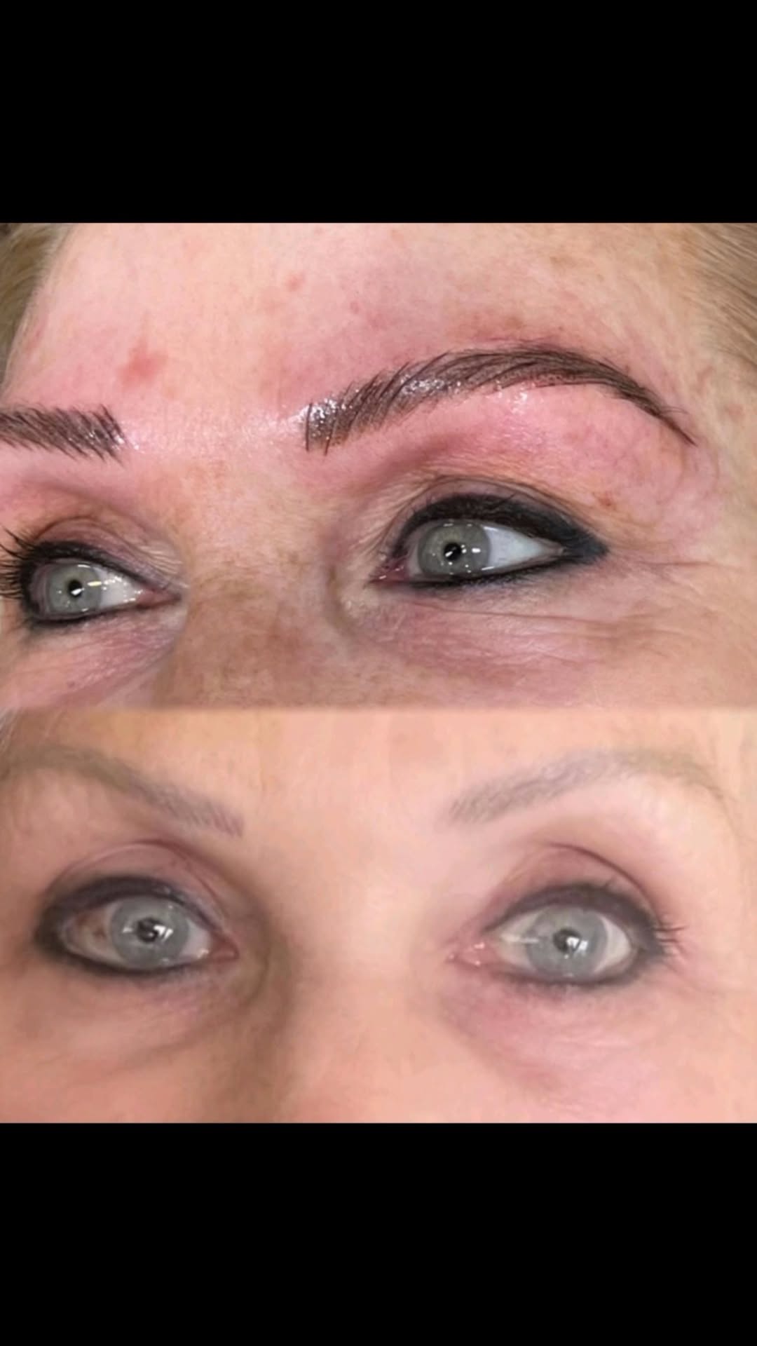 Brow Consultation