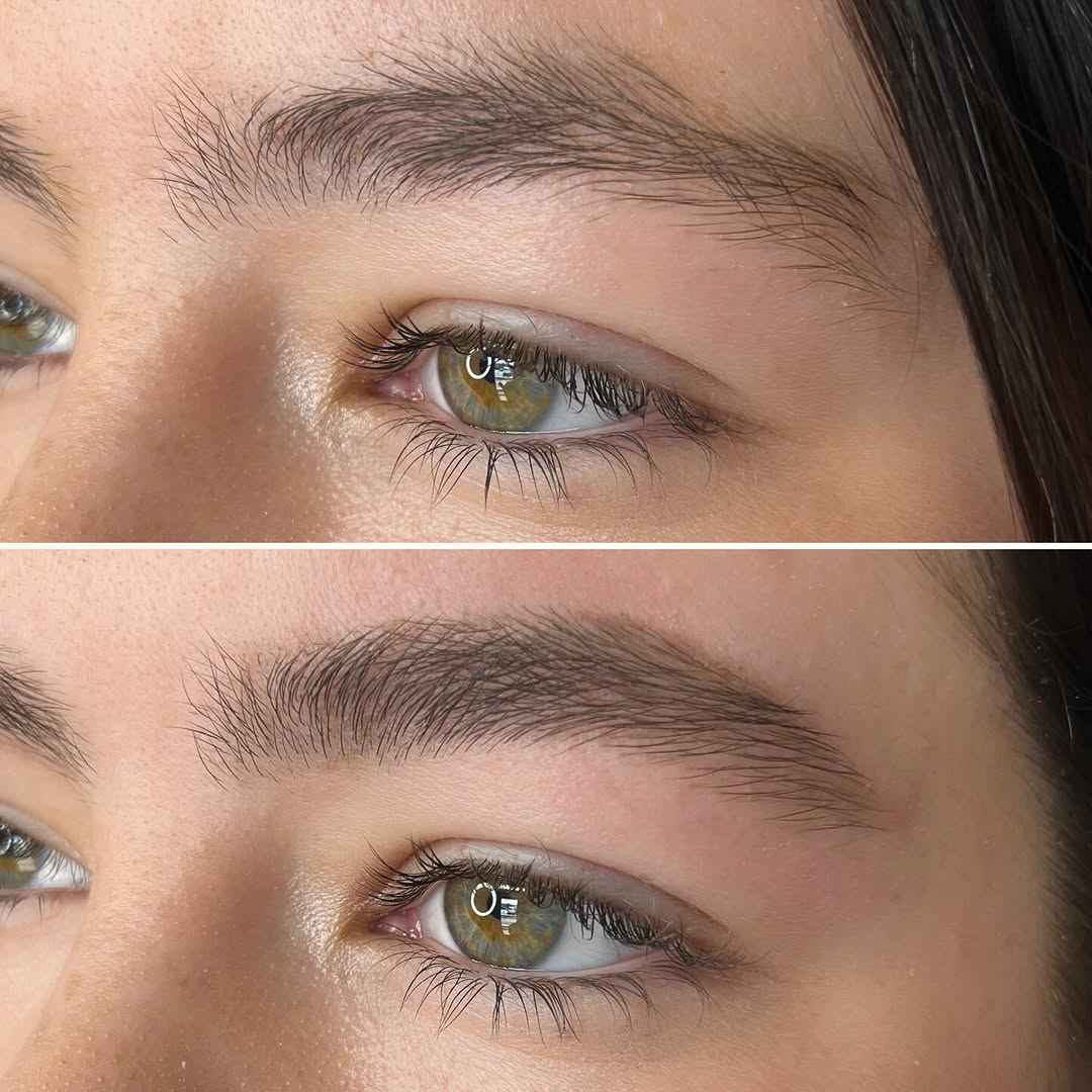Teen Brow Care