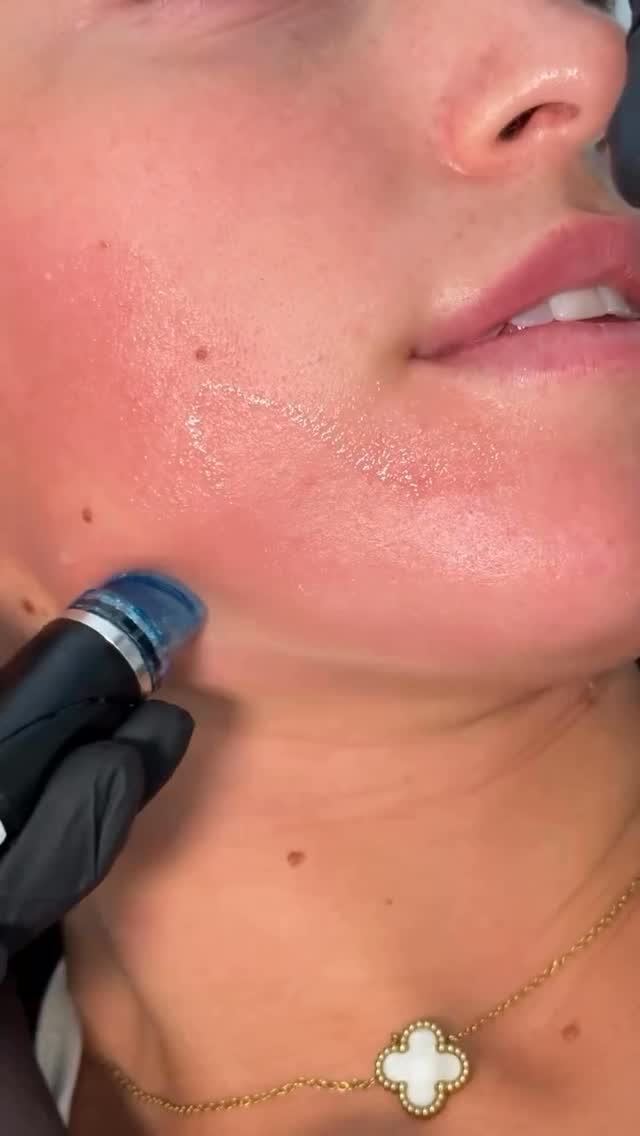 Skin Hydration Therapy